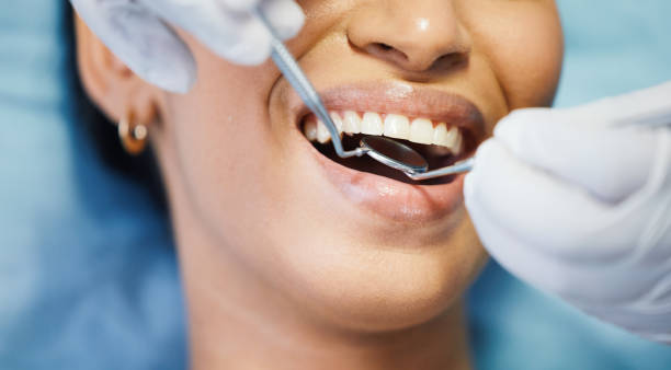 Best Cracked Tooth Emergency Dentist  in Chillicothe, OH