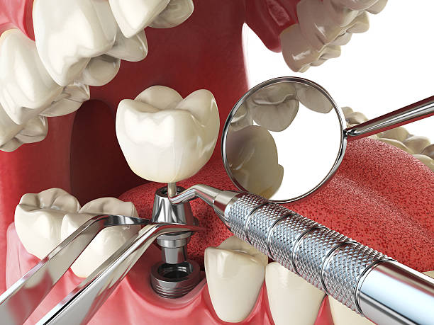 Best Urgent Tooth Repair  in Chillicothe, OH